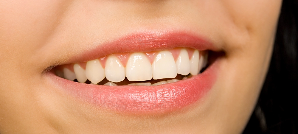 benefits of full mouth restoration