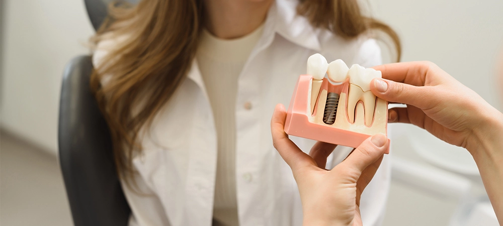 dental implant procedure take